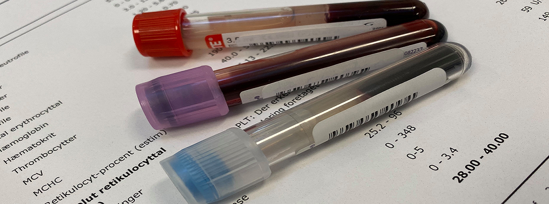 Blood collection tubes