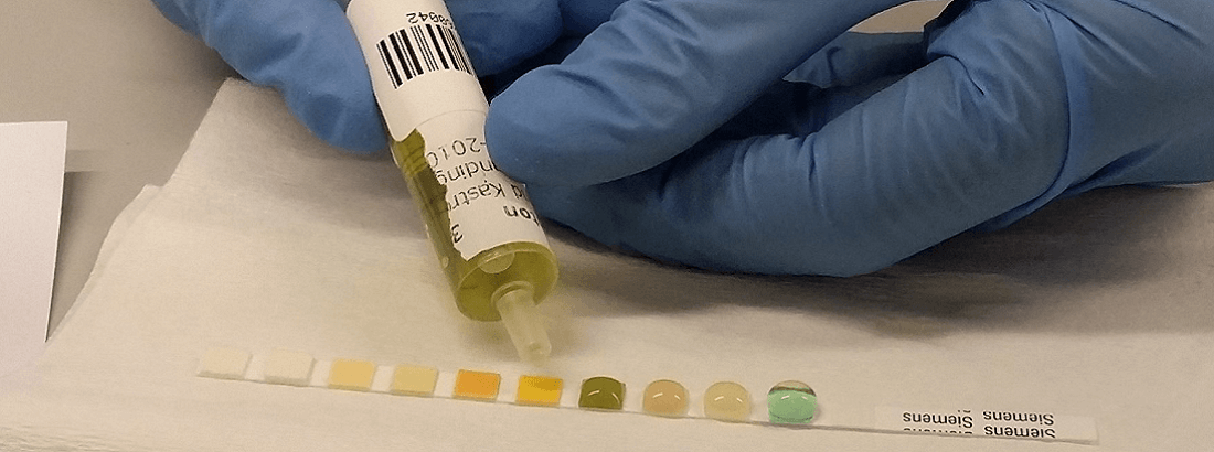 Urine dipstick analysis
