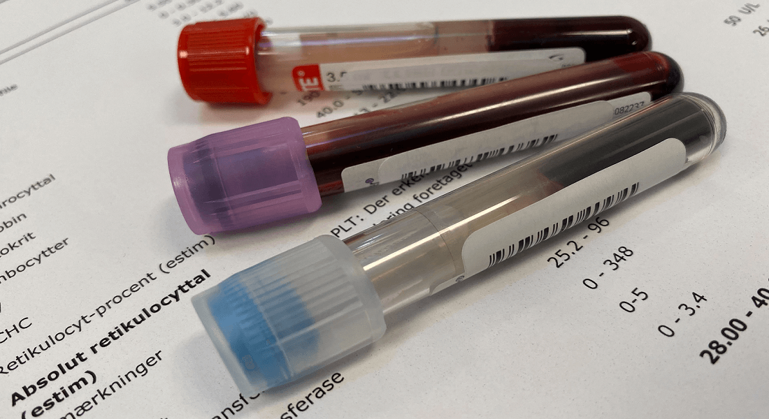 Blood sample tubes